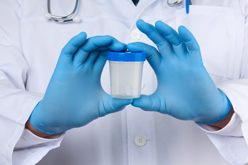 person holding urinalysis container